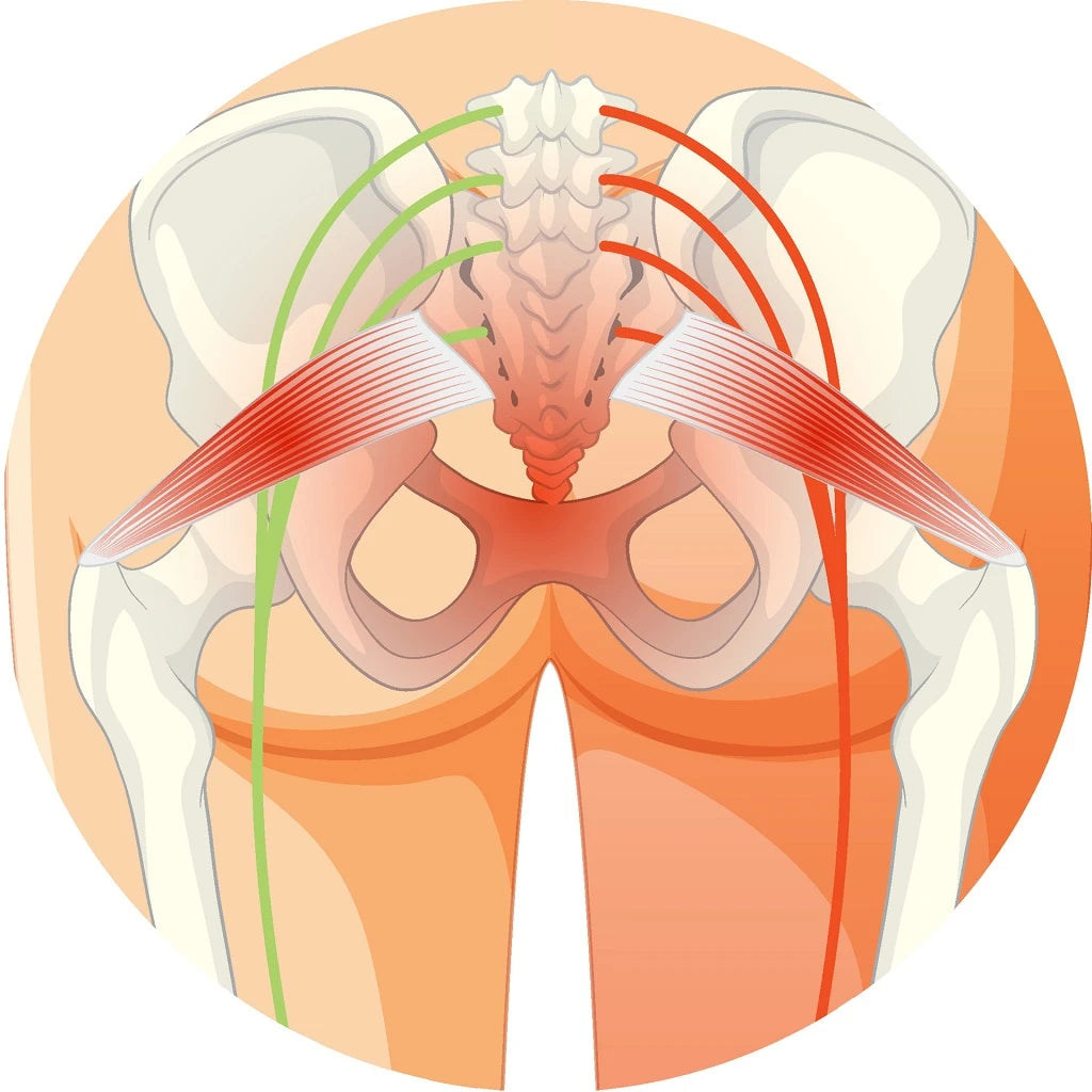 What hip pain looks like.