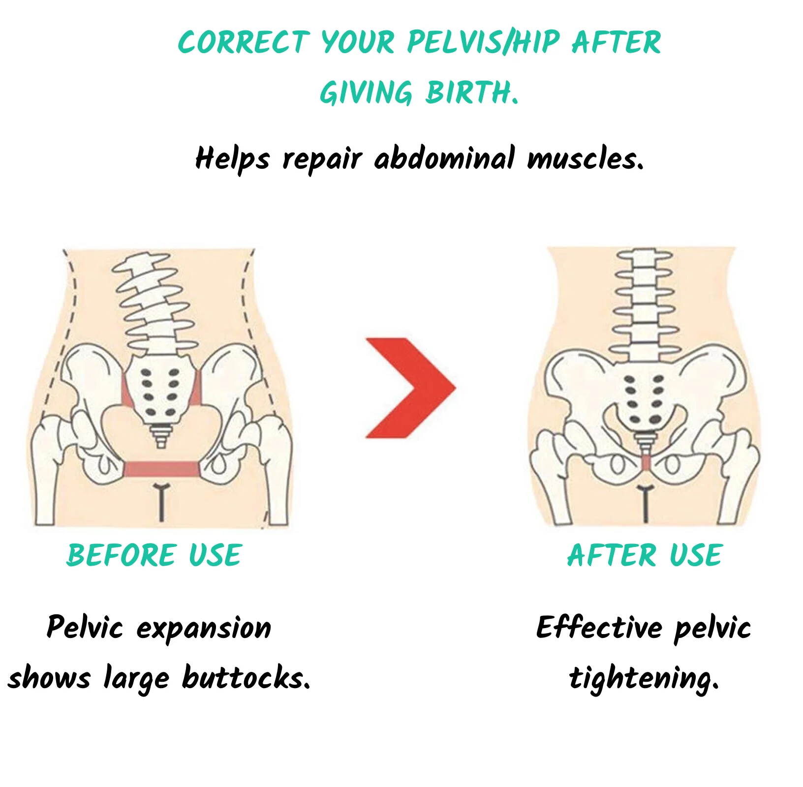 Pelvic expansion before and after.